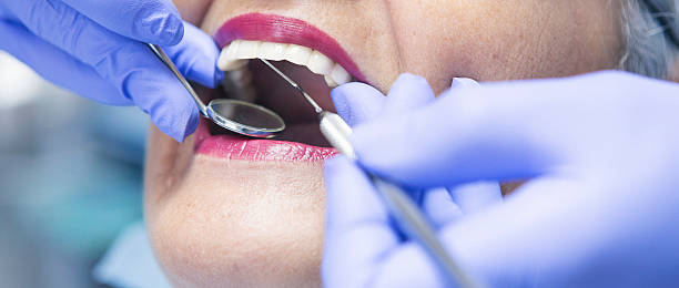 Best Emergency Tooth Extraction  in Howey In The Hills, FL