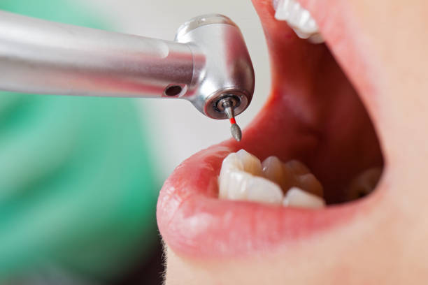 Best Cracked Tooth Emergency Dentist  in Howey In The Hills, FL